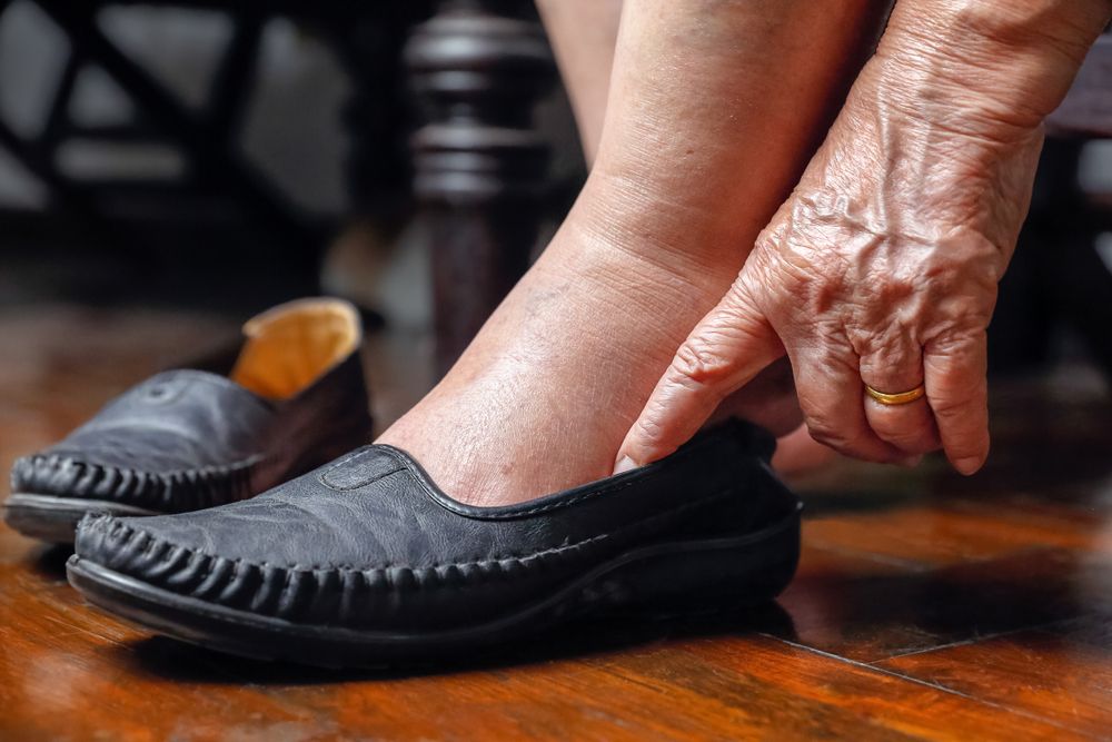 La importancia de elegir unos zapatos confort para los diabéticos